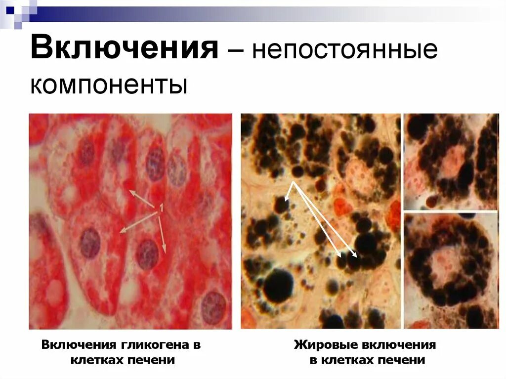 Включения жира в клетках печени амфибии. Включения гликогена в клетках печени. Гликоген в клетках печени под микроскопом. Липидные включения в клетках печени.