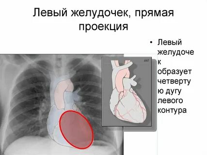 Проекция левого