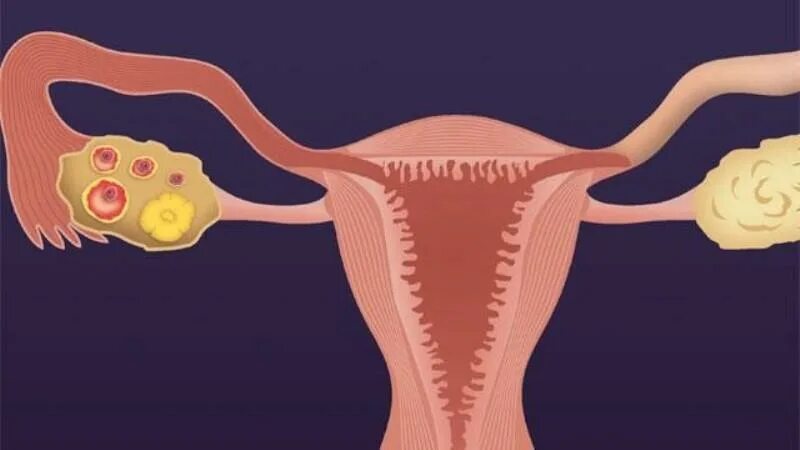Менструальный цикл желтое тело. Овуляция. Менструация желтое тело. Овуляция губы
