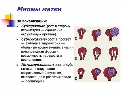 У человека в норме развивается матка