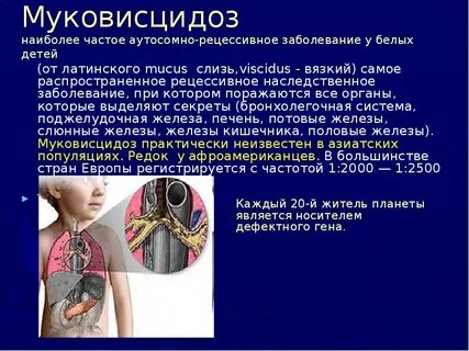 Муковисцидоз это