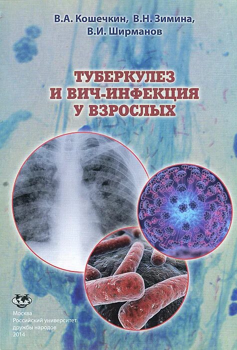 Туберкулез книга. Туберкулез и ВИЧ инфекция у взрослых Зимина. Туберкулез и ВИЧ инфекция фтизиатрия.