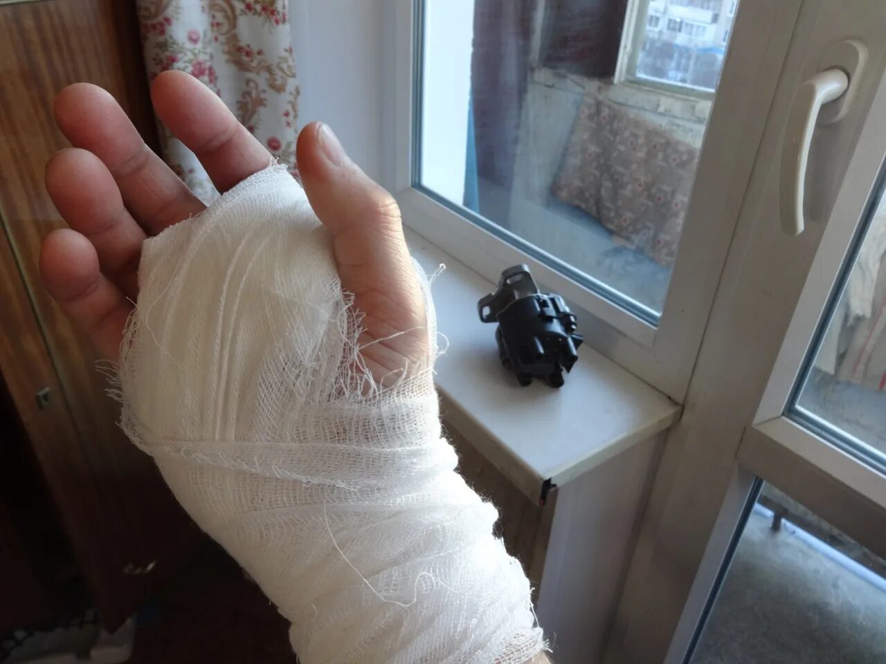 Операция на большом пальце руки