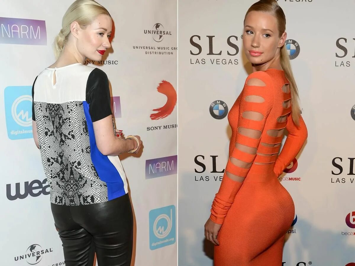 Iggy Azalea before. Iggy Azalea before and after Plastic. Включи iggy