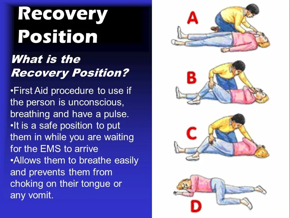 Recovery position. Положение «рекавери». Recovery position first Aid. Спасательная позиция Recovery. First position