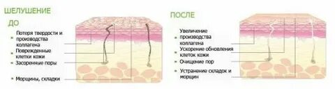 Ороговевший слой кожи