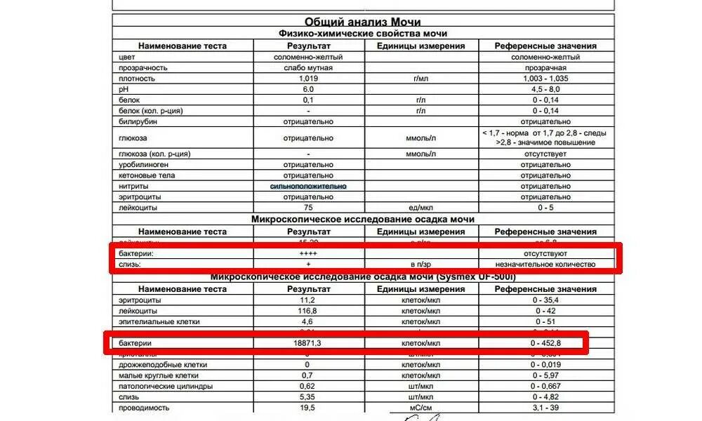 Бактерии в моче ОАМ норма. Анализ мочи расшифровка бактерии норма. Моча бактерии норма таблица. Норма микроорганизмов в моче у беременных. Слизь в моче плюс