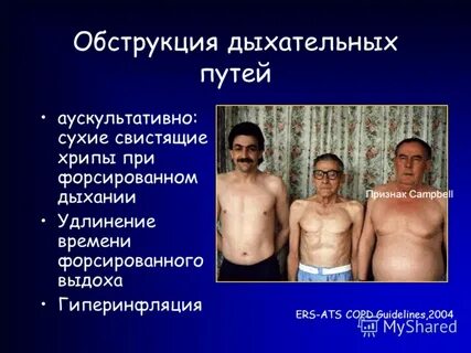 Хрипы в животе