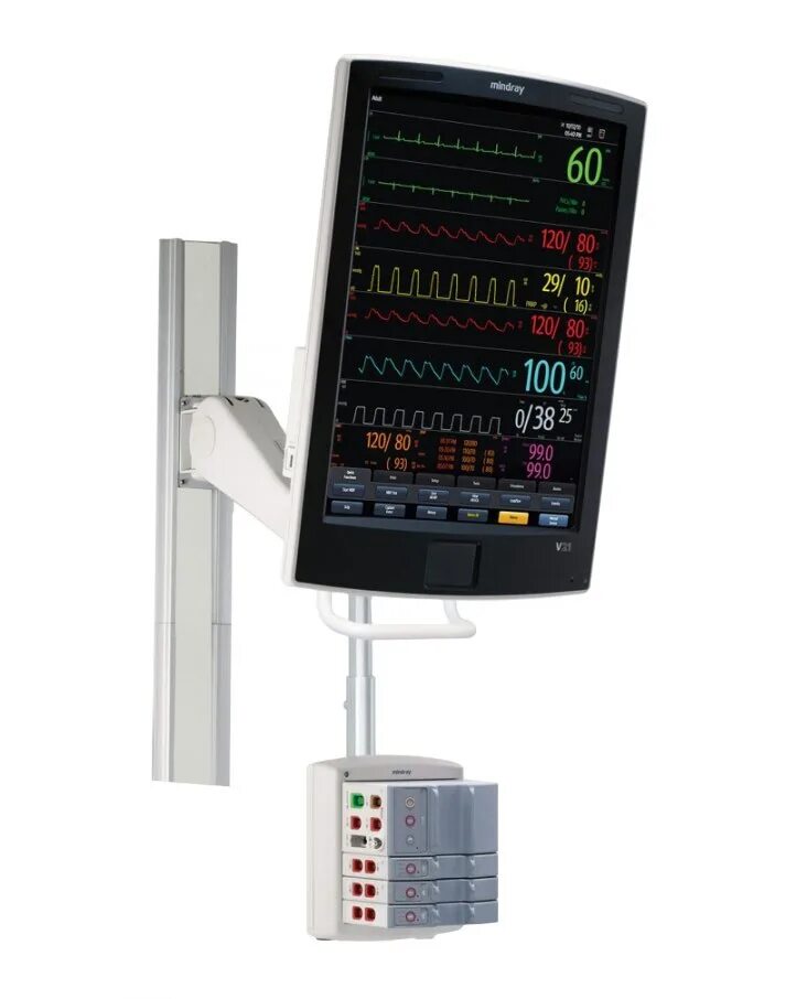 Монитор анестезии. Монитор пациента Миндрей. Mindray v21 монитор пациента. Монитор пациента Mindray BENEVIEW t9. Монитор пациента модульный IPM 12, Mindray, Китай.