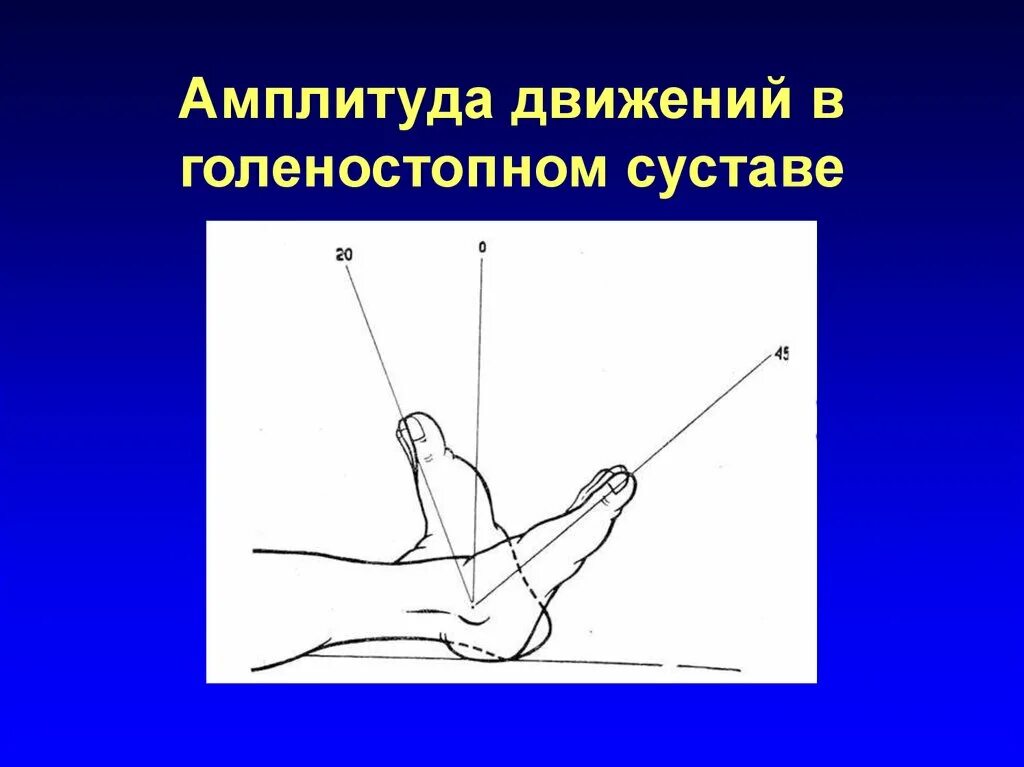 Амплитуда движений в голеностопном суставе. Амплитуда движений в суставах. Объем движенийголенностопного сустава. Объем движений в голеностопном суставе.