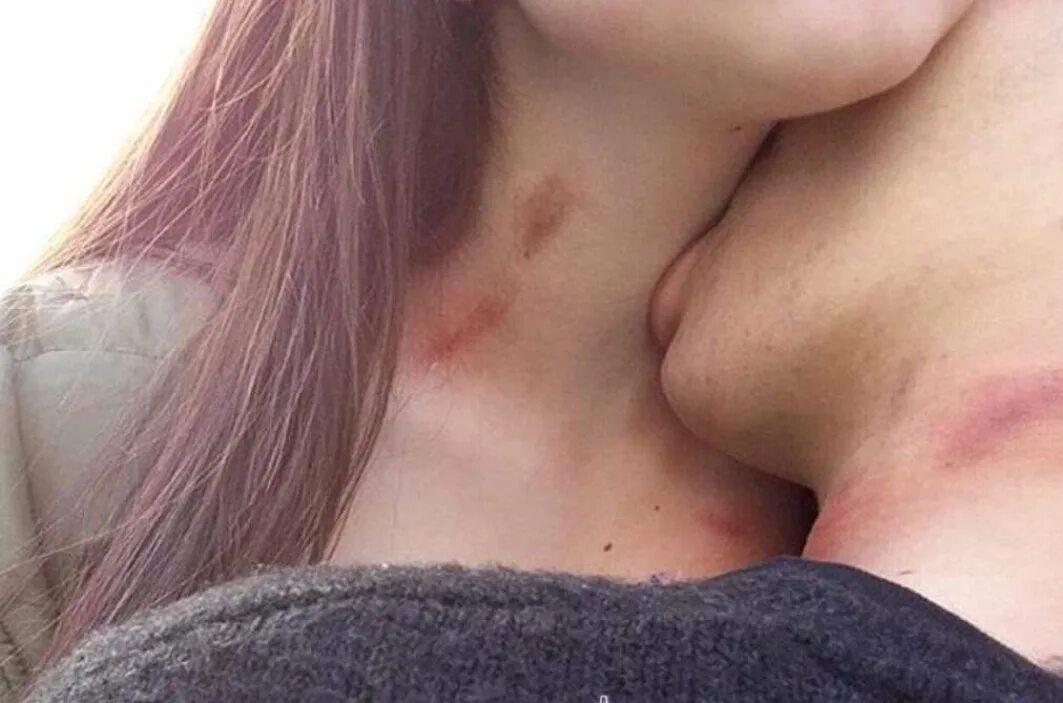 Поцелуй в шею. Девушка делает засос парню. Женщина сверху. Целует в шею. Поцелуи в интимных местах.