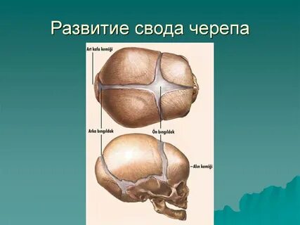 Свод черепа кости