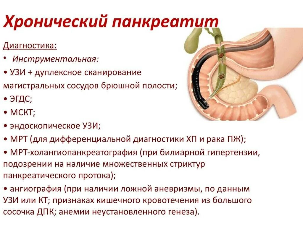 Хронические заболевания поджелудочной. Хронический панкреатин симптомы. Хронический панкреатит. Хронически йпанкреотит. Панкреатит поджелудочной железы.