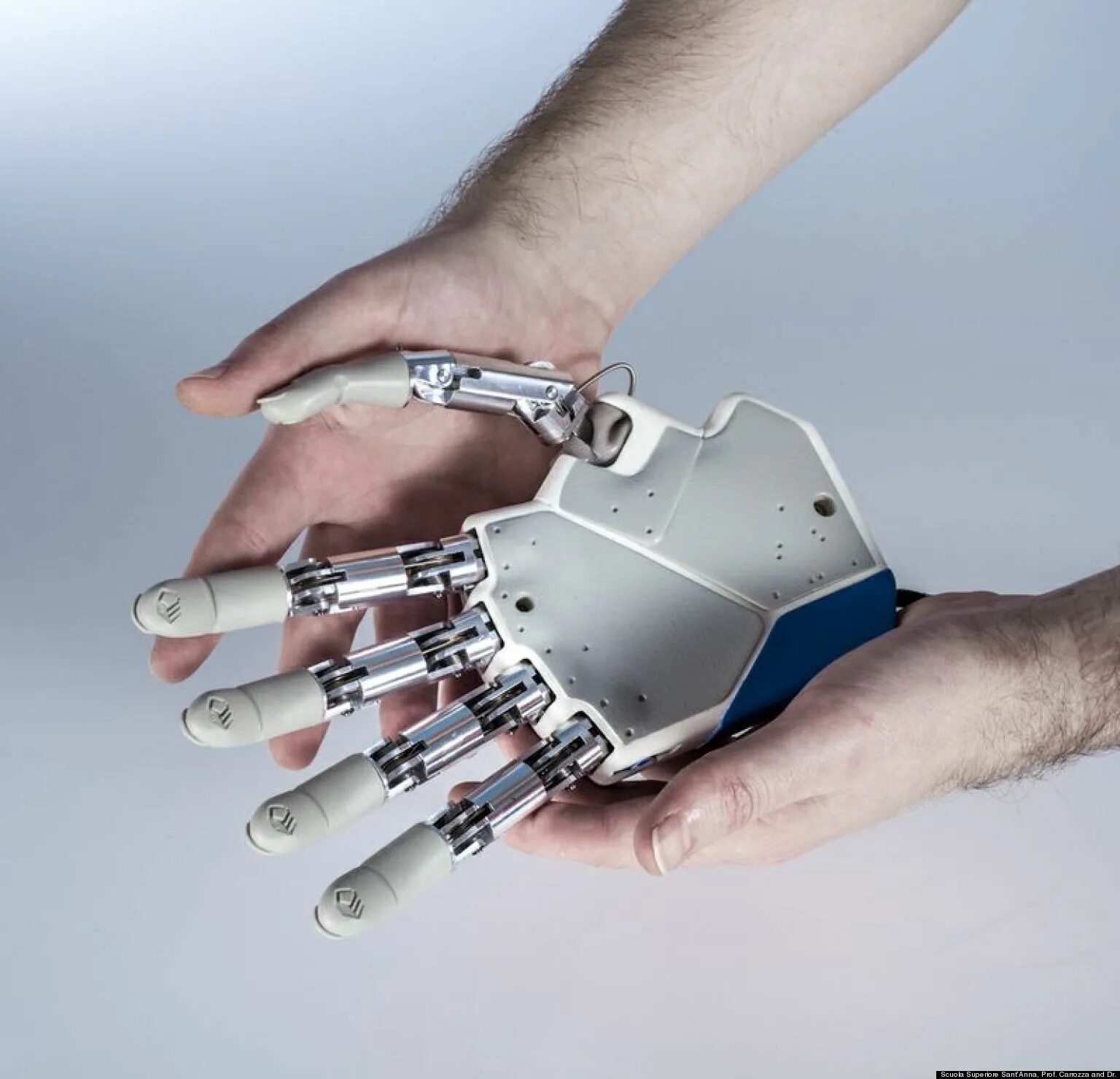 Touch Bionics протезы. Бионический протез пальца. Bionica протезы. Протез руки Bionic. Бионика медицинский