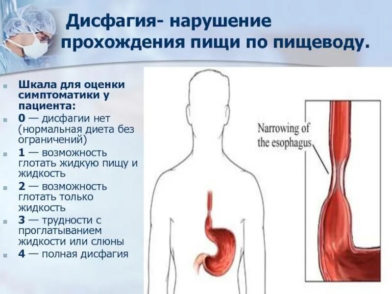 Дисфагия пищевода симптомы. Дисфагия обусловлена поражением. Синдром дисфагия симптомы. Заболевания пищевода. Синдром дисфагии..