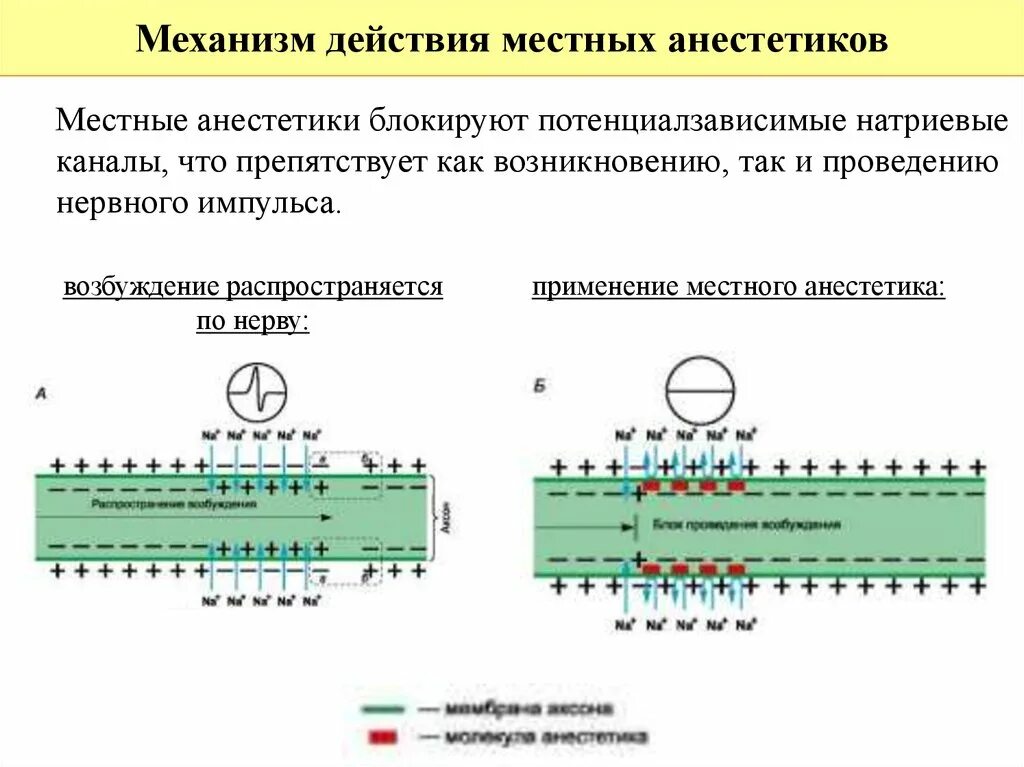 Местные анестетики механизм действия схема. Механизм действия местных анестетиков фармакология схема. Лидокаин механизм действия местноанестезирующих. Механизм действия местных анестетиков в стоматологии. Распространение пд