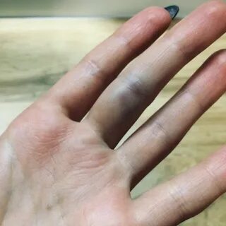 Косточки на указательном пальце руки