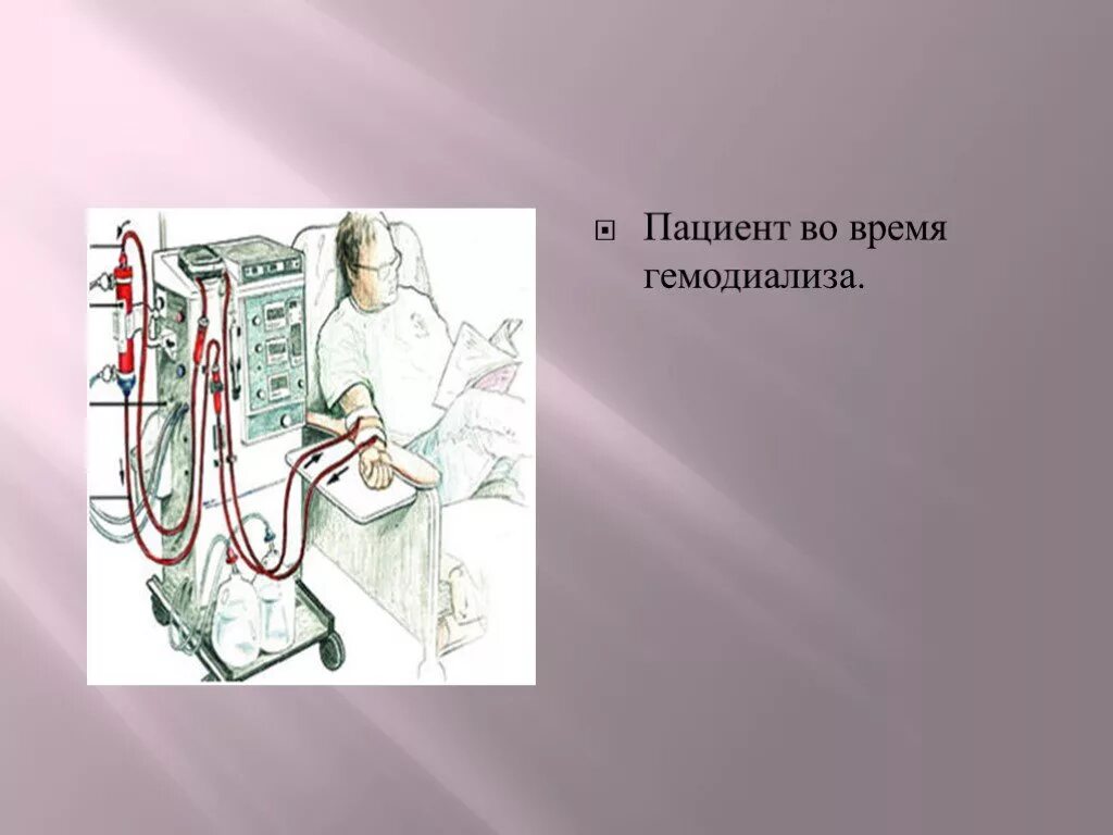 Давление при гемодиализе