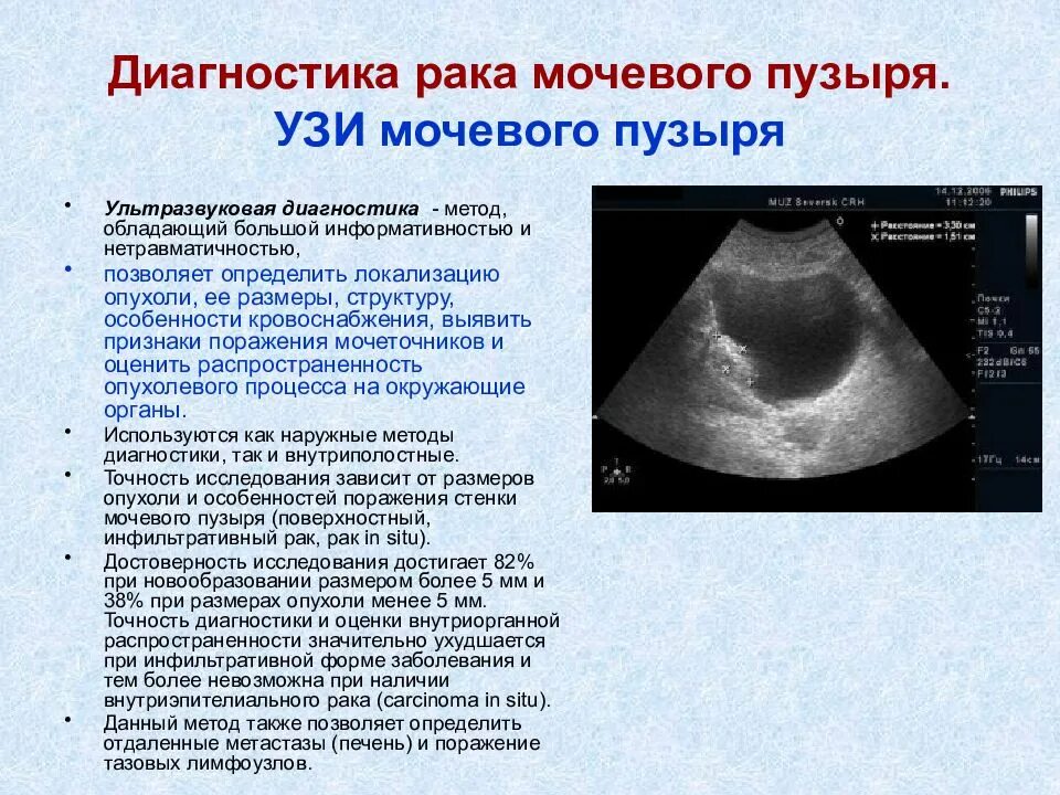 УЗИ почек. УЗИ мочевого пузыря. Опухоль мочевого пузыря на УЗИ описание. Образования мочевого пузыря на УЗИ. Ультразвуковое исследование мочевого пузыря показания.