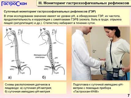 Ph пищевода