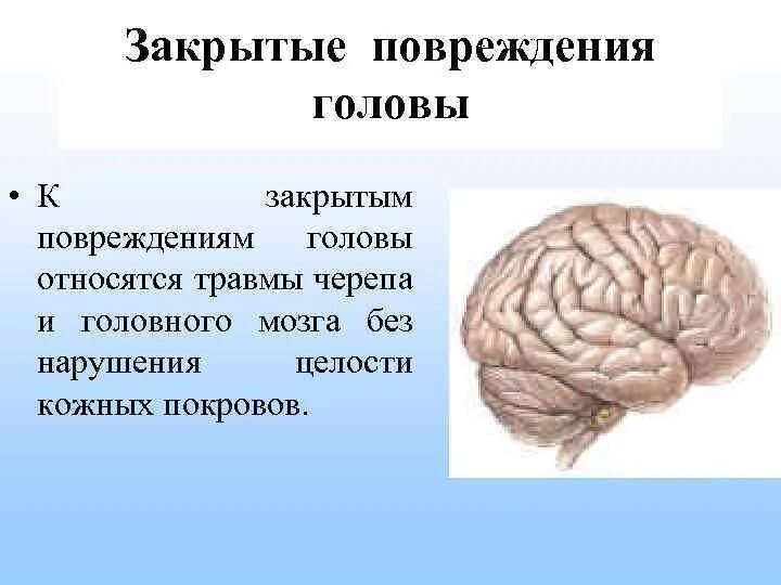 Травмы головы классификация. Травмы черепа и головного мозга. Закрытые повреждения черепа и головного мозга. Открытая травма мозга