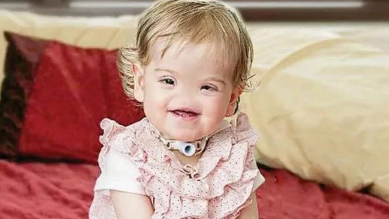 Девочка без носа. Девочка без носа. Девочка без носа. Девочка без носа тесса эванс. Тесса эванс девочка родившаяся без носа.