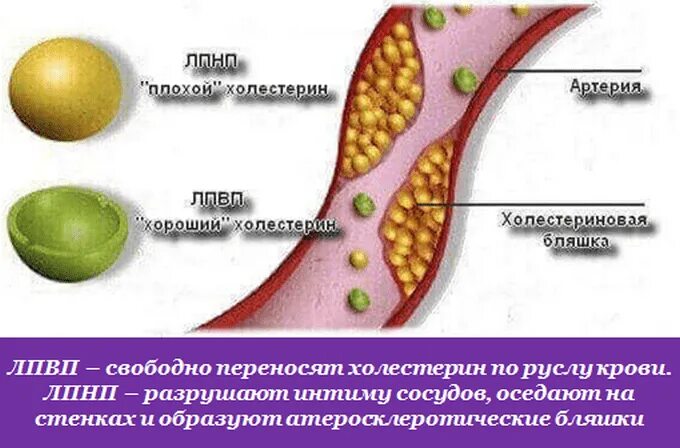 Низкий холестерин низкой плотности в крови