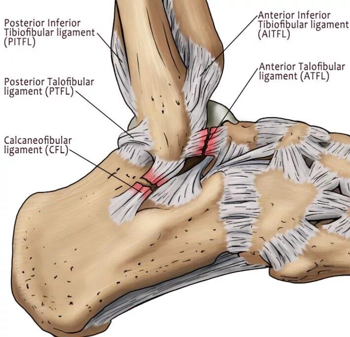 Связки голеностопного сустава анатомия разрыв. ATFL голеностопный сустав. Медиальная дельтовидная связка голеностопного сустава. Дельтовидная связка голеностопного сустава анатомия.