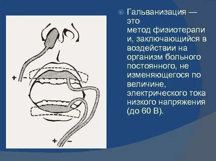 Гальванические токи в полости рта