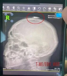 Любовь это пуля застрявшая в нашей голове