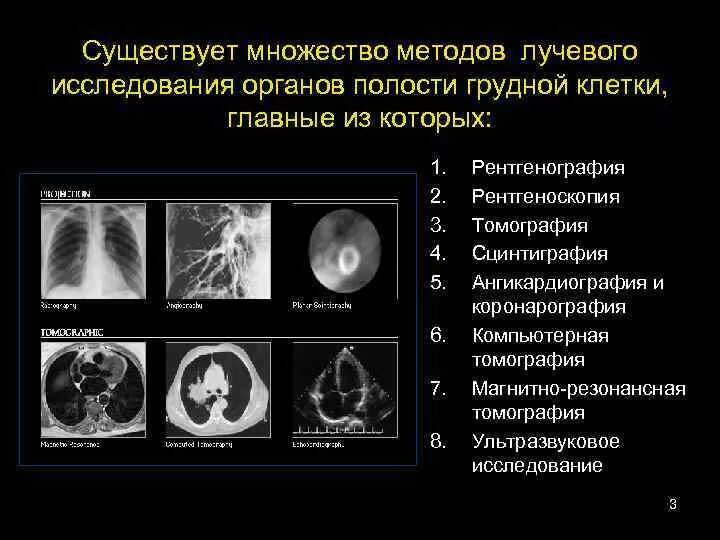 Метод радиальных. Методы лучевой диагностики органов грудной клетки. методики кт исследования грудной полости. метод диагностики грудной клетки. лучевые методы исследования органов грудной клетки.