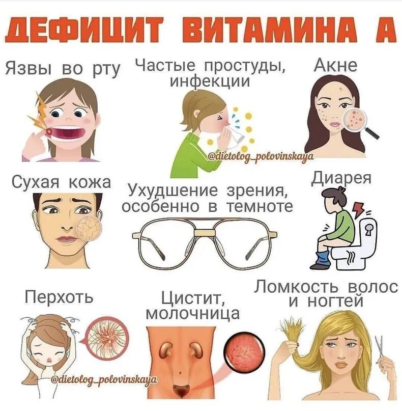 Заболевания при недостатке е. Признаки дефицита витамина с. Признаки нехватки витамина с. Дефицит витамина а симптомы.