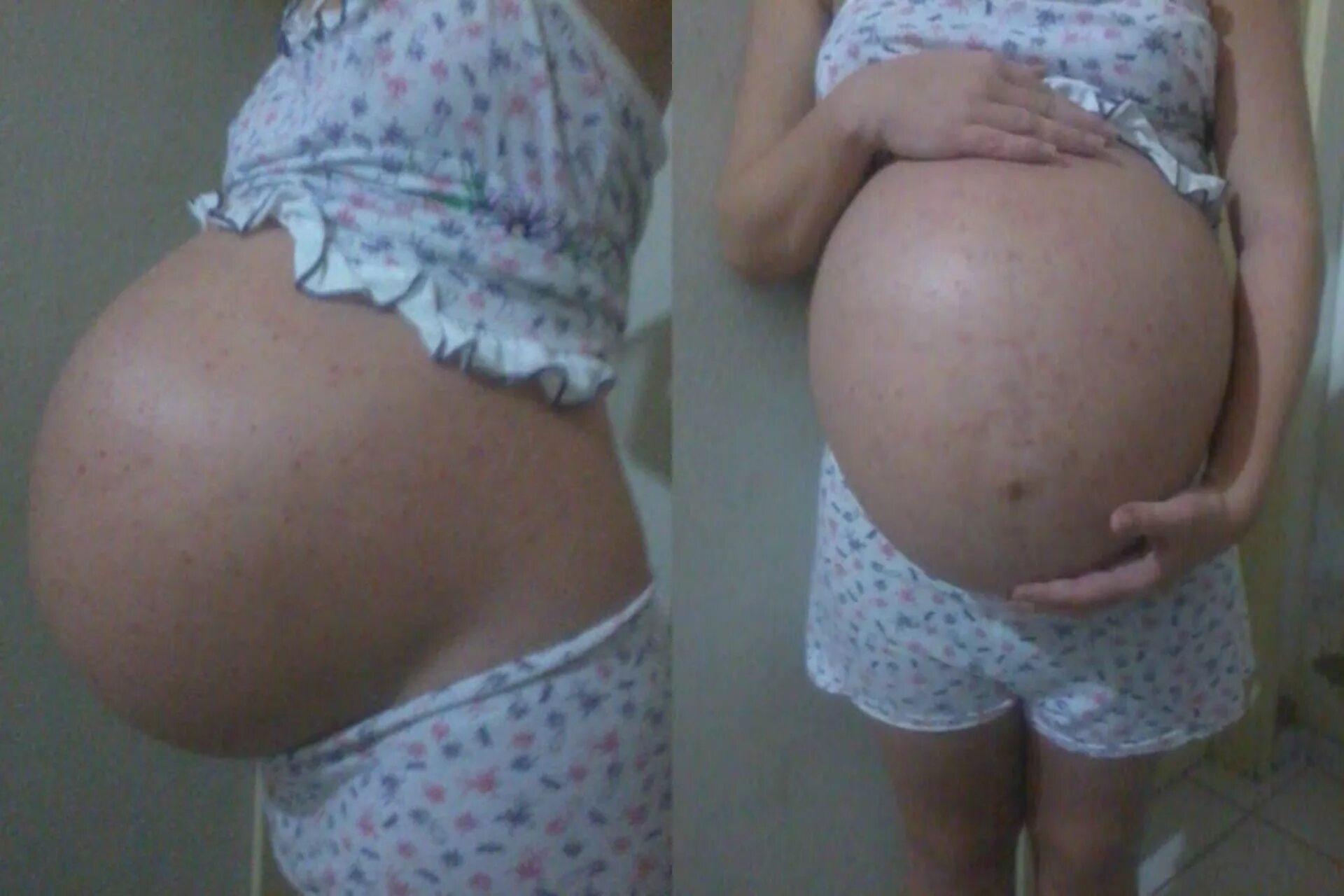34 недели беременности фото. Животик с двойней по неделям. Многоплодная беременность живот. Живот по неделям беременности двойней. Беременный живот двойней.