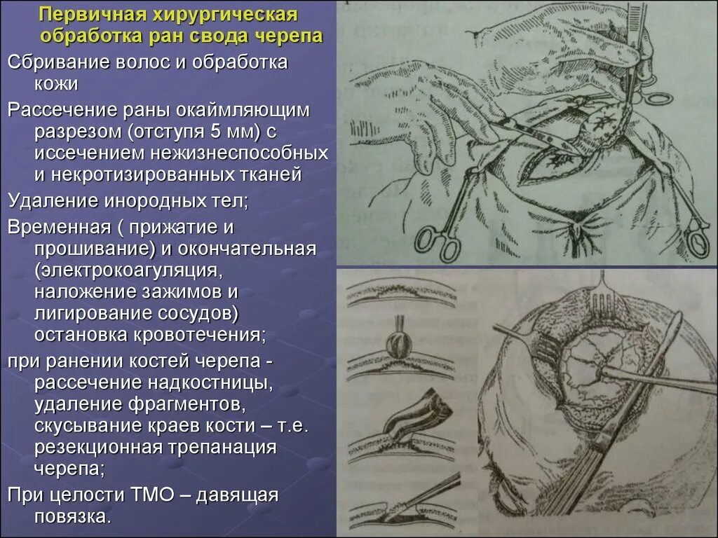 Первичная хирургическая обработка непроникающих РАН свода головы. Первичная хирургическая обработка непроникающих РАН свода черепа. Пхо Оперативная хирургия. Пхо проникающих и непроникающих РАН свода черепа.