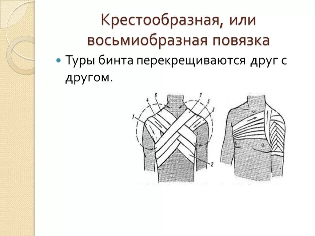 Крестообразная повязка. Крестообразная десмургия. Десмургия восьмиобразная. Десмургия колосовидная повязка. Десмургия восьмиобразная повязка.