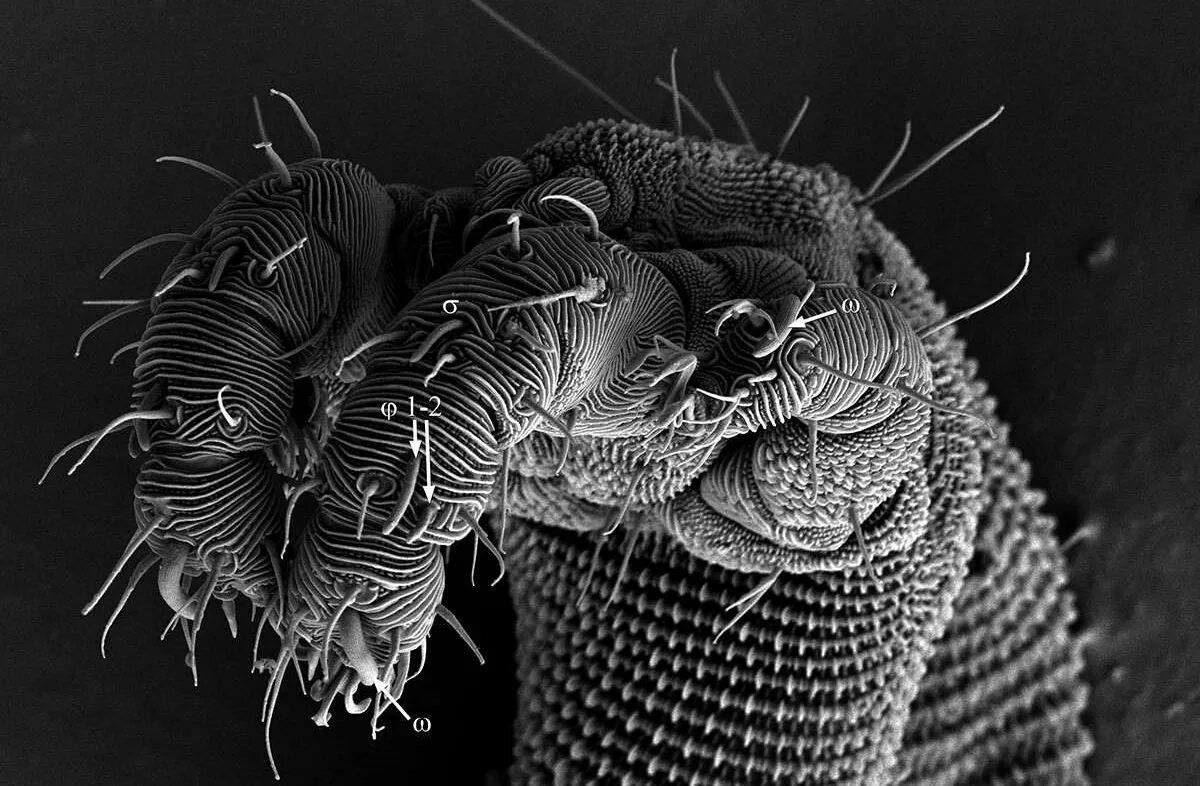 Цифровой червь. Морская полихета под микроскопом. Червяк тихоходка. Микрофотография дождевого червя. Тихоходка микрофотография.