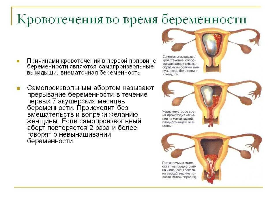 Пошла кровь во время акта