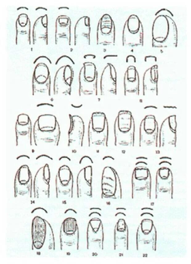 О чем говорит форма ногтей. Формы ногтей криминалистика. Формы ногтей и элементы ногтевой пластины криминалистика. Следы ногтей человека в криминалистике. Криминалистика о форме ногтей на руках.