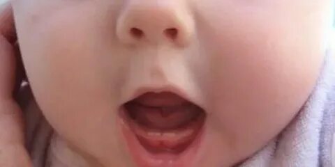 3 месяца зубы режутся как понять