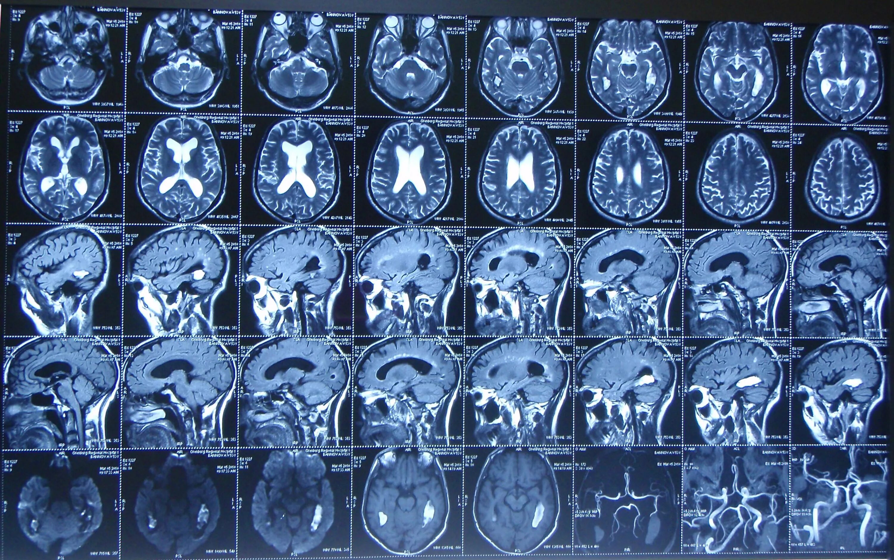 Кт головы москва. Кт томограмма головного мозга. Компьютерная томография кт головного мозга. Магнитно-резонансная томография мрт снимки. Магнитно резонансные томограммы головного мозга.