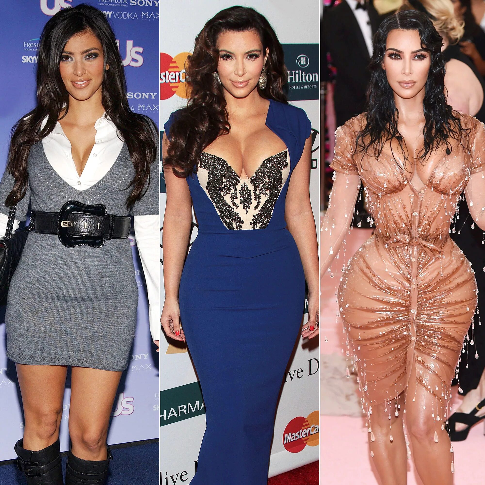 13 Plastic Surgery Before And After Photos (Amazing) - NoWayGirlTV Kardashian pl