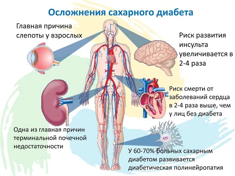 Осложнения раз. Осложнения сахарного диабета 1 и 2 типа. Осложнения сахарного диабета 2 типа. Осложнения при сахарном диабете 1 типа и 2 типа. Осложнения СД 2 типа.