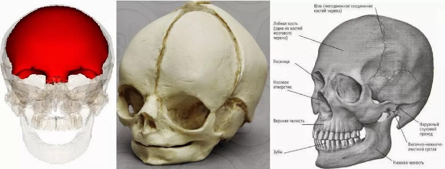Sinus frontalis на лобной кости. Выпирает лобная кость. Выпирает лобная кость. Выпирает лобная кость. Выпирает лобная кость.