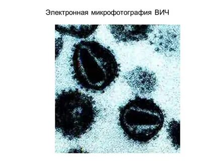 Вирус вич под микроскопом