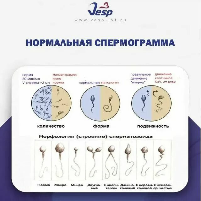 Подготовка к спермограмме. Спермограмма подготовка. подготовка к сдаче спермограммы. как подготовиться к спермограмме.