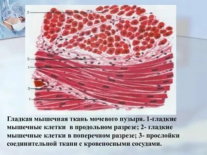 Какую ткань стенки