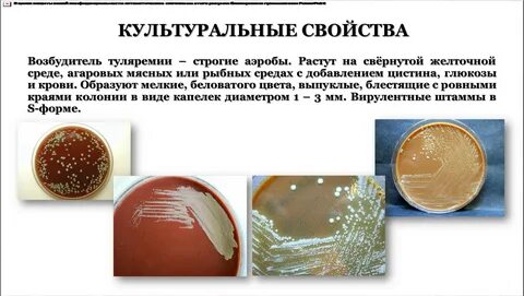 Выберите возбудитель туляремии
