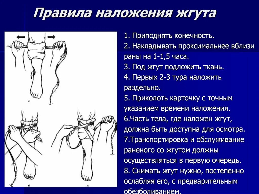 Наложение артериального жгута на нижнюю конечность. Наложить венозные жгуты на конечности. Наложение венозных жгутов на конечности алгоритм. Правила наложения венозного жгута. Наложение жгутов на конечности при отеке легких.