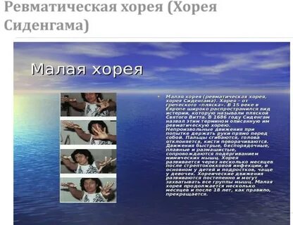 Пляска святого витта что это за болезнь