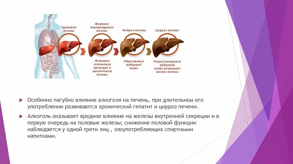 Влияние наркотиков на печень. Влияние спирта на печень.